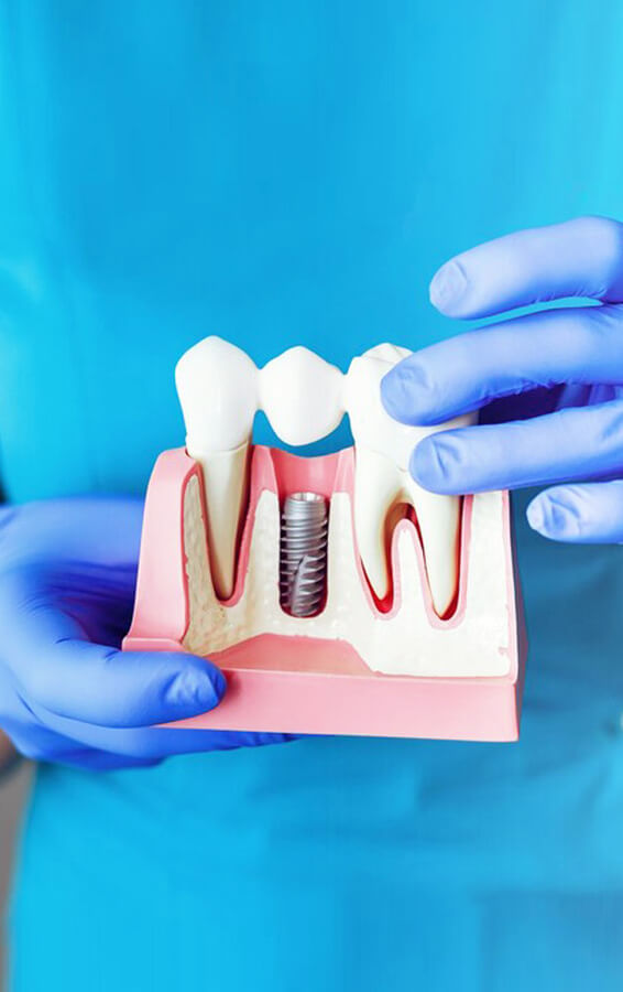 Dental Implants Winfield, IL Winfield Family Dentistry