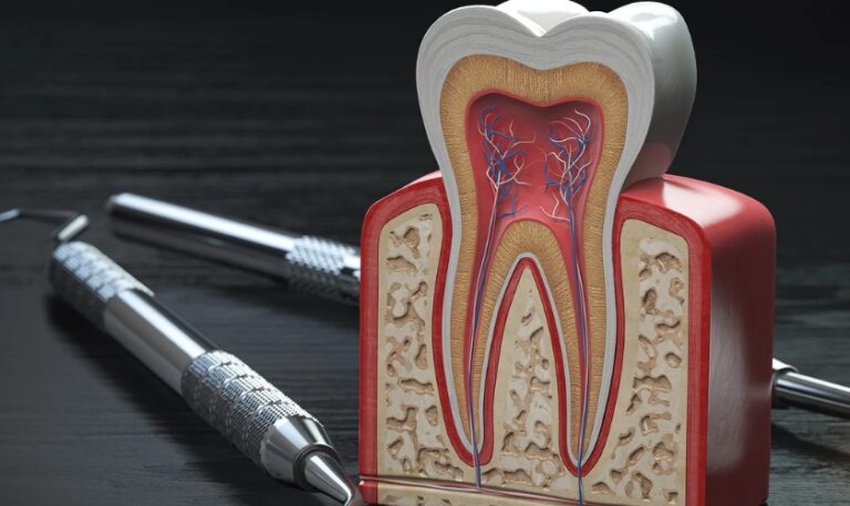 Vibrant Can Antibiotics Heal An Infected Root Canal Capture for Your Screen Vibrant Can Antibiotics Heal An Infected Root Canal Capture for Your Screen
